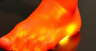 Диагностика педалей: износ накладки — как вовремя распознать тревожный сигнал и не попасть в неприятности